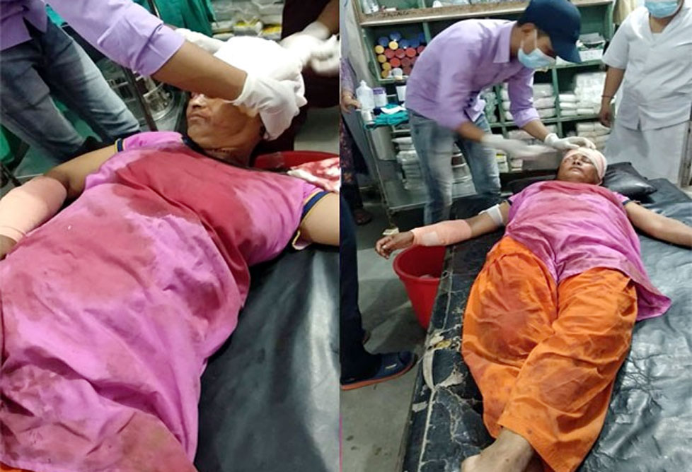 बघुवाके आक्रमणसे एक महिला घाहिल