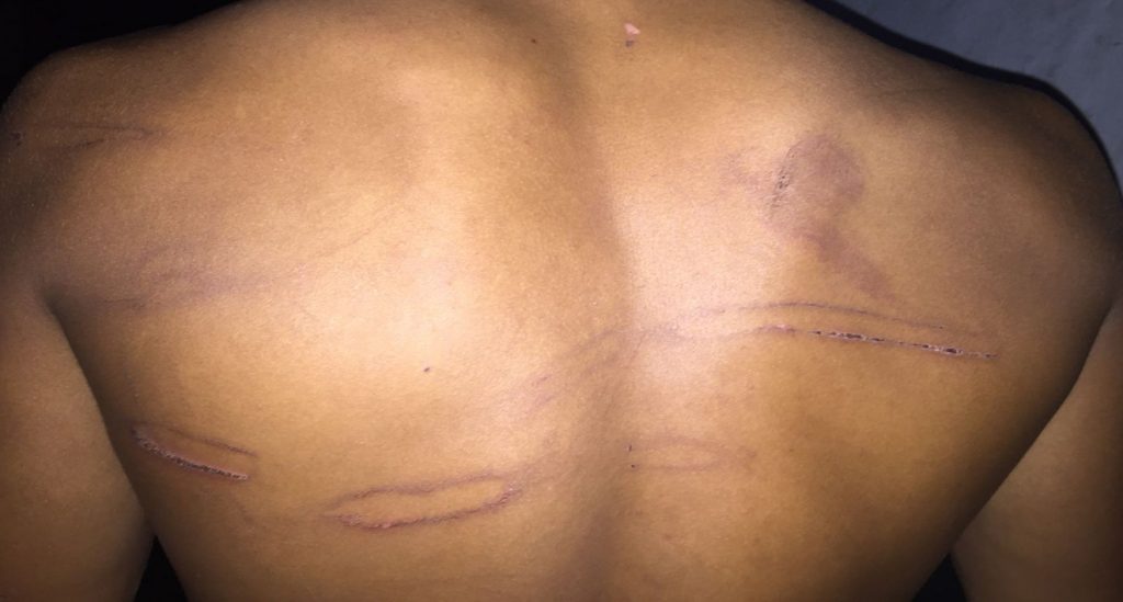 भारतिय बनरक्षकसे दुई नेपालीहे कुटपिट